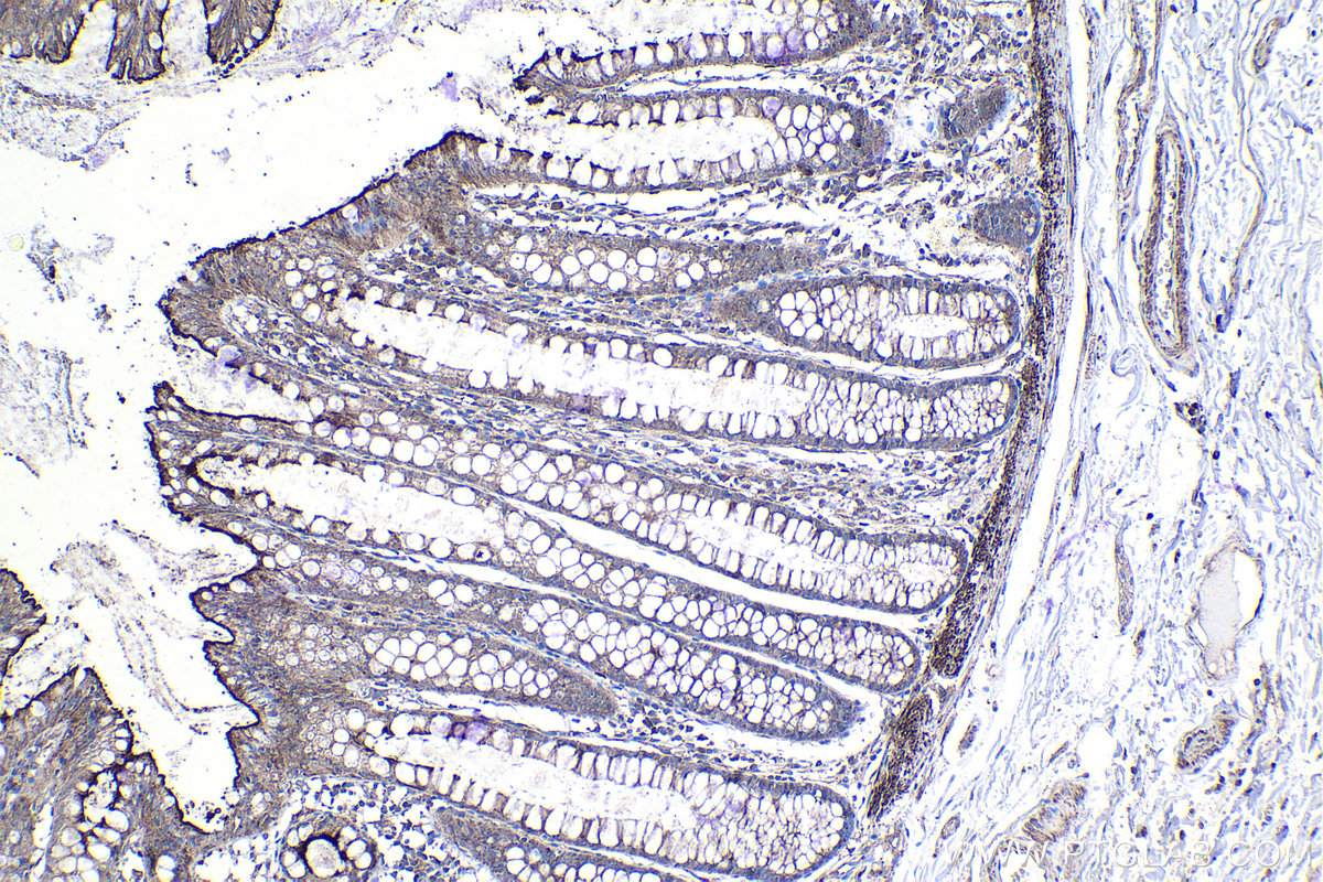 IHC staining of human colon using 66456-1-Ig (same clone as 66456-1-PBS)