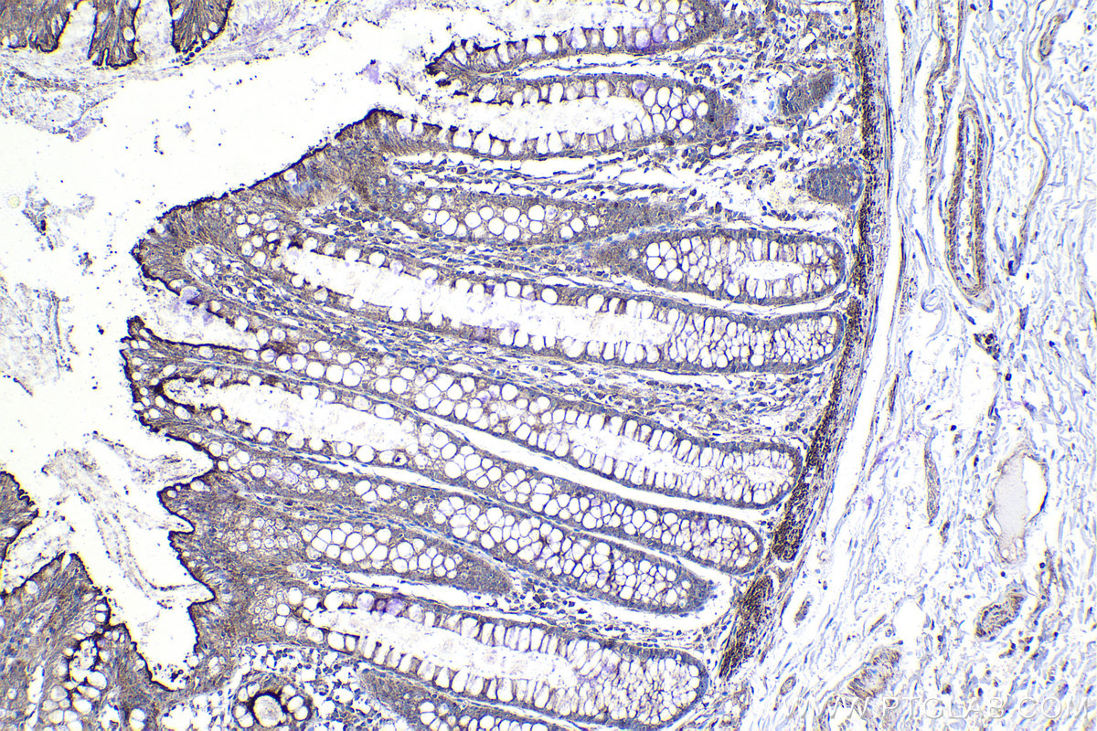 IHC staining of human colon using 66456-1-Ig