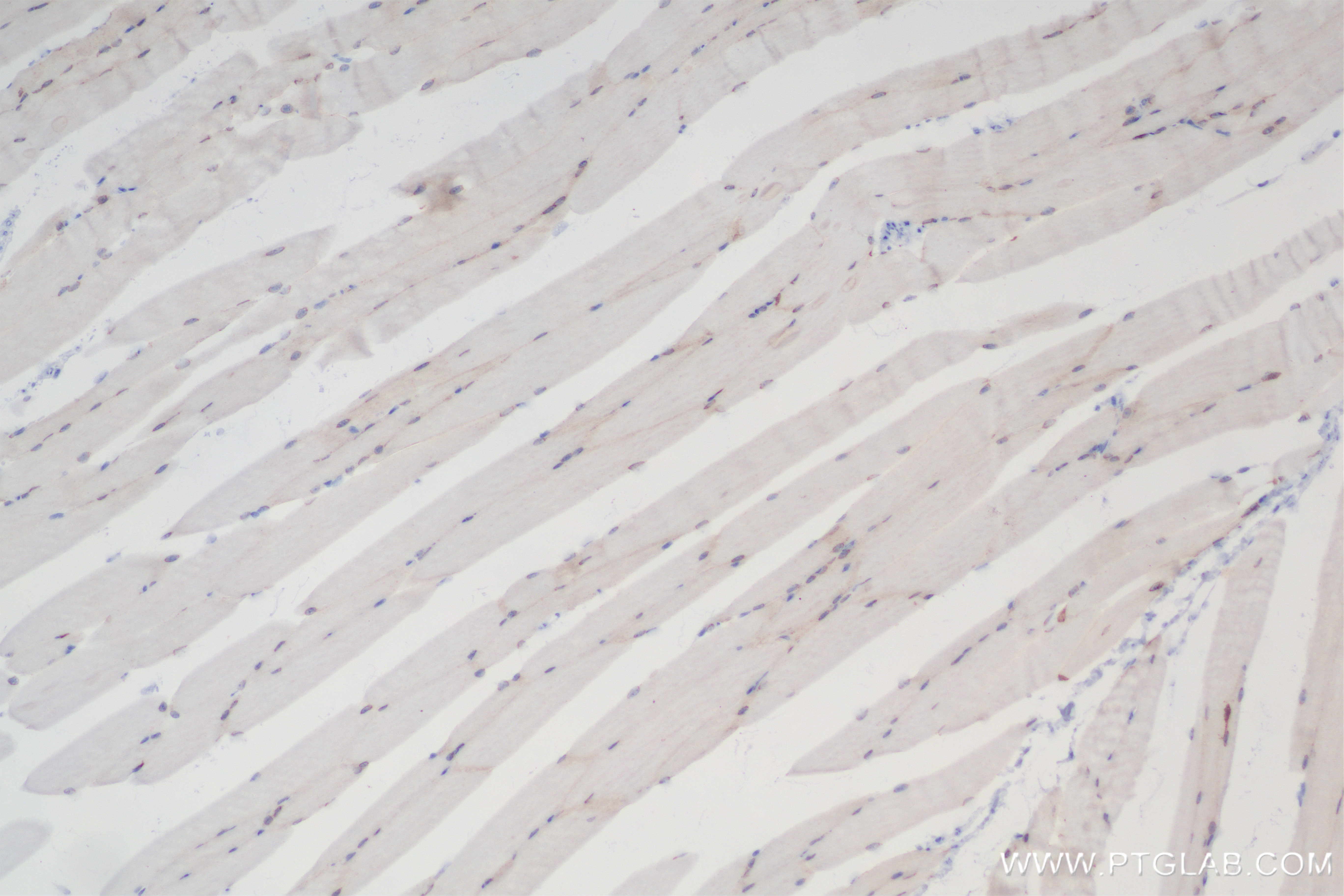 IHC staining of mouse skeletal muscle using 84440-5-RR (same clone as 84440-5-PBS)