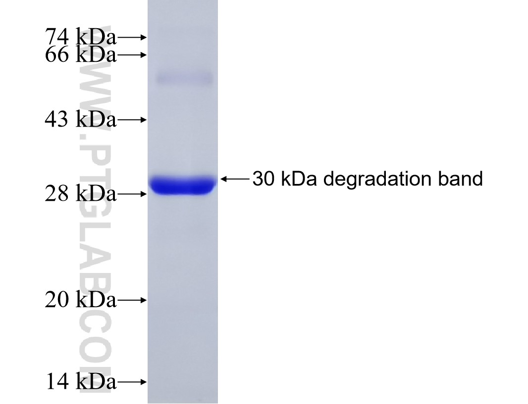M6PR fusion protein Ag10259 SDS-PAGE M6PR fusion protein Ag10259 SDS-PAGE