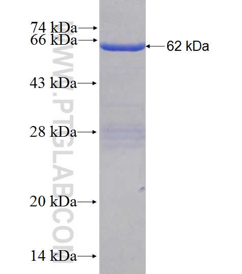 M6PRBP1 fusion protein Ag1028 SDS-PAGE