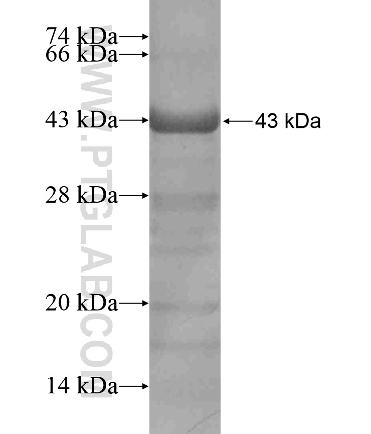 MACC1 fusion protein Ag17445 SDS-PAGE MACC1 fusion protein Ag17445 SDS-PAGE