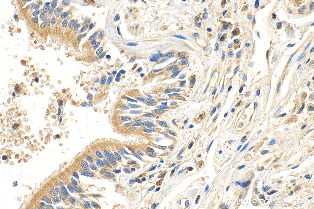 IHC staining of human lung using 13058-1-AP