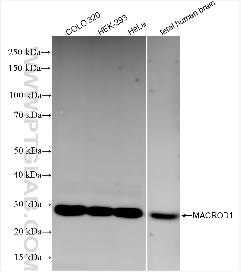 WB analysis using 84398-3-RR