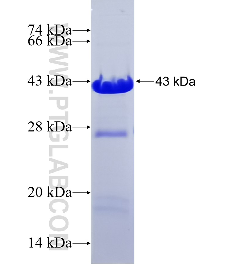 MACROD2 fusion protein Ag37368 SDS-PAGE MACROD2 fusion protein Ag37368 SDS-PAGE