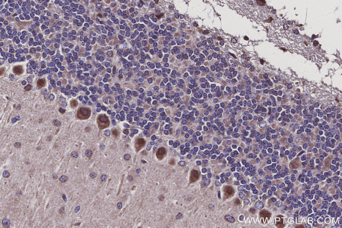 IHC staining of mouse cerebellum using 18322-1-AP IHC staining of mouse cerebellum using 18322-1-AP