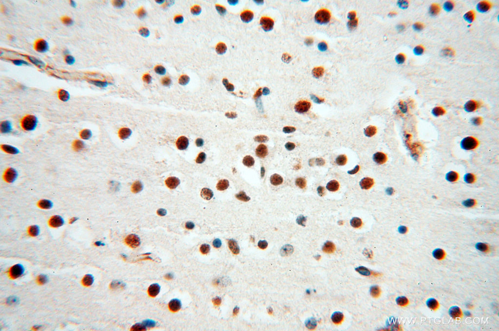 IHC staining of human brain using 18322-1-AP