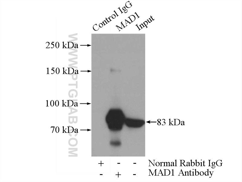 IP experiment of HeLa using 18322-1-AP