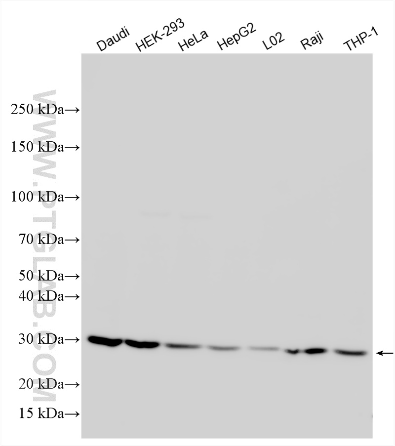 WB analysis using 10337-1-AP WB analysis using 10337-1-AP
