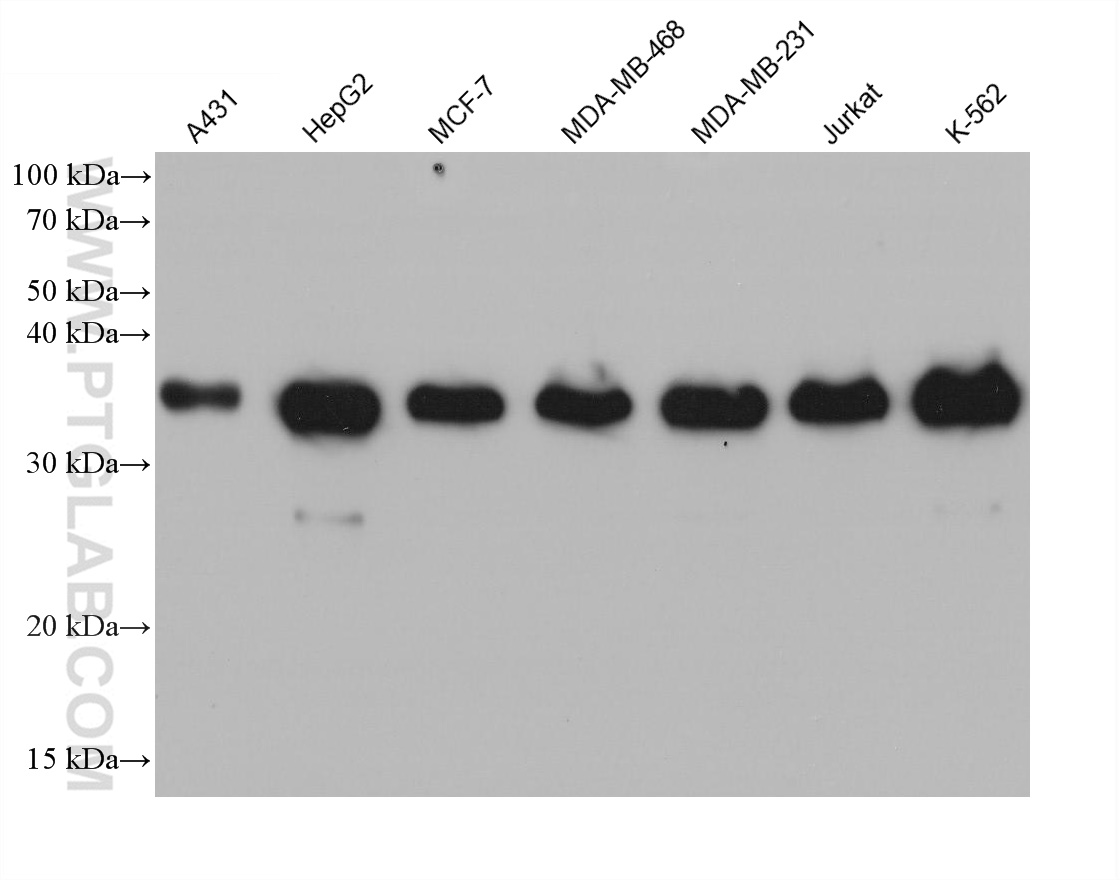 WB analysis using 68336-1-Ig (same clone as 68336-1-PBS)