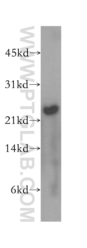 MAD2L2 Polyclonal antibody