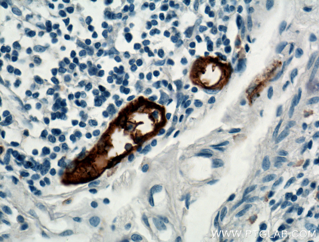 IHC staining of human small intestine using 21917-1-AP