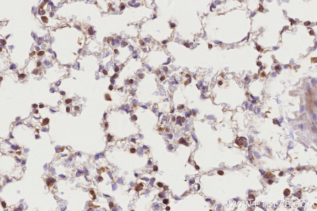 IHC staining of mouse lung using 29663-1-AP IHC staining of mouse lung using 29663-1-AP