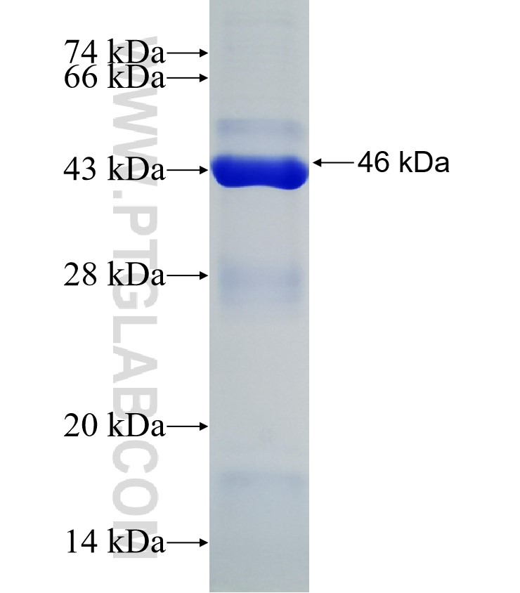 MADD fusion protein Ag31292 SDS-PAGE