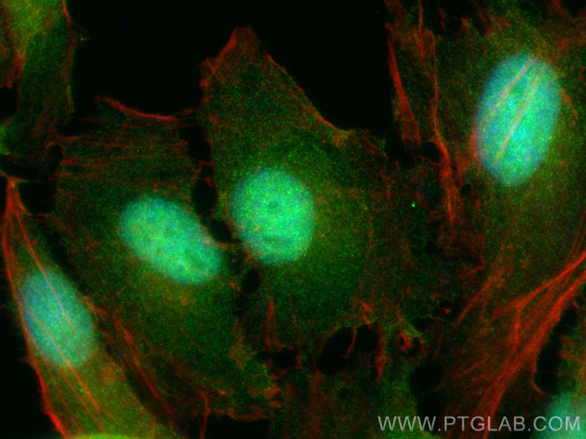 IF Staining of HeLa using RMX00005