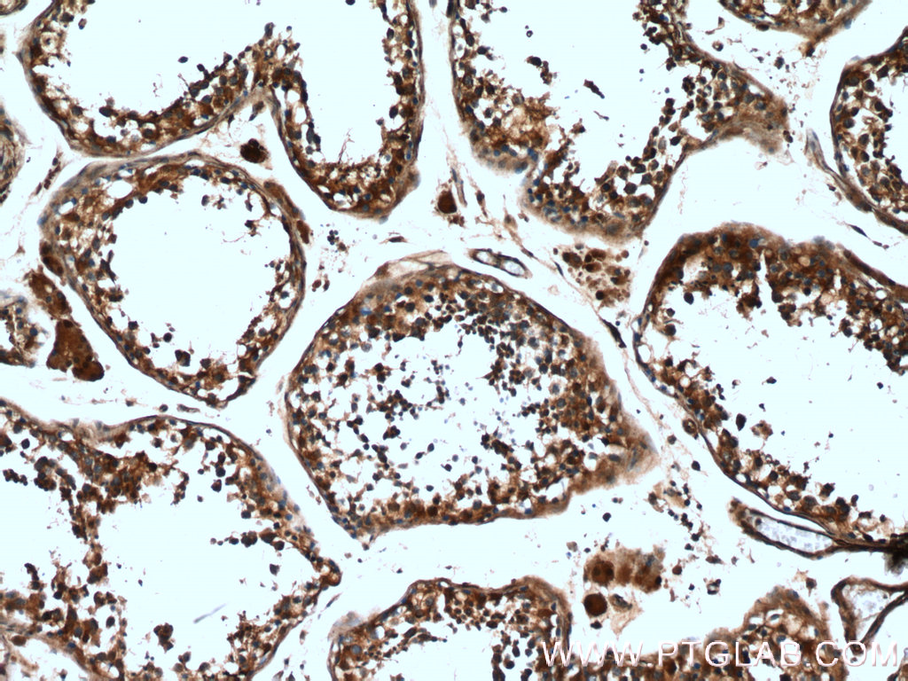 IHC staining of human testis using 26666-1-AP