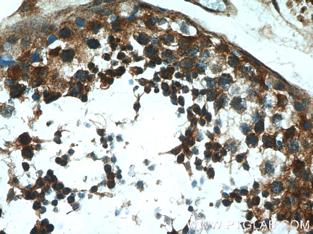 IHC staining of human testis using 26666-1-AP