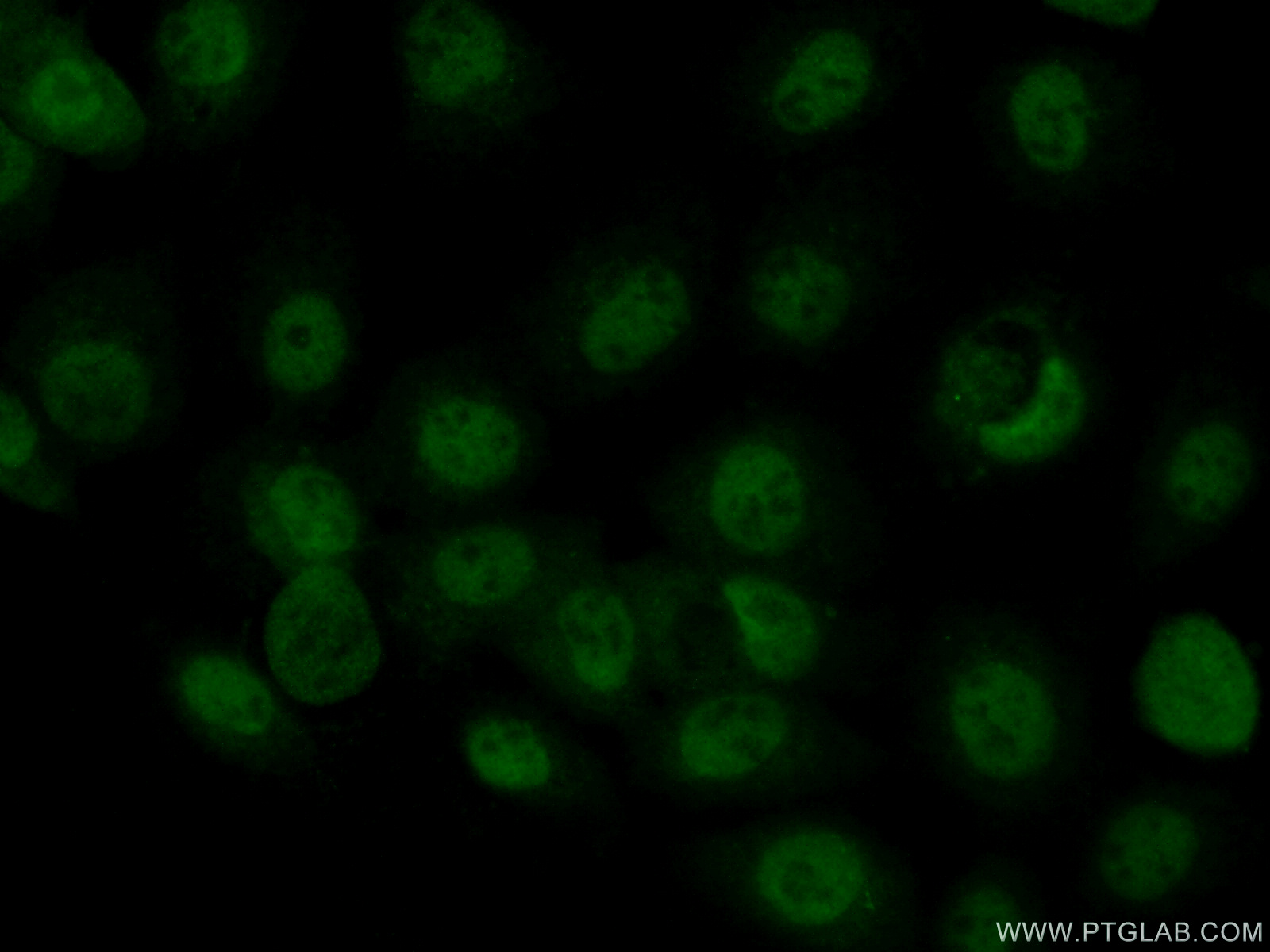 IF Staining of A431 using 55013-1-AP