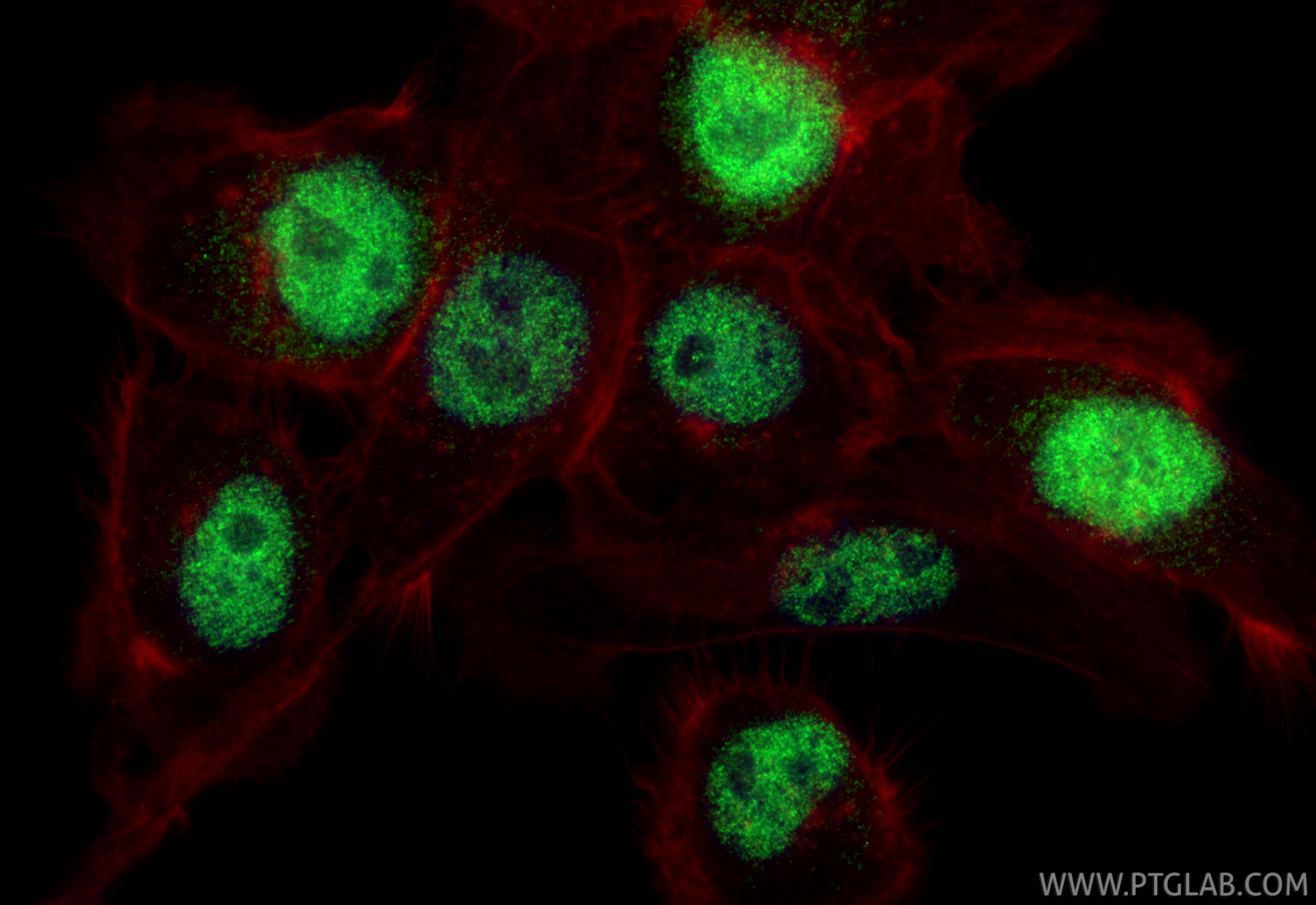 IF Staining of A431 using 55013-1-AP IF Staining of A431 using 55013-1-AP