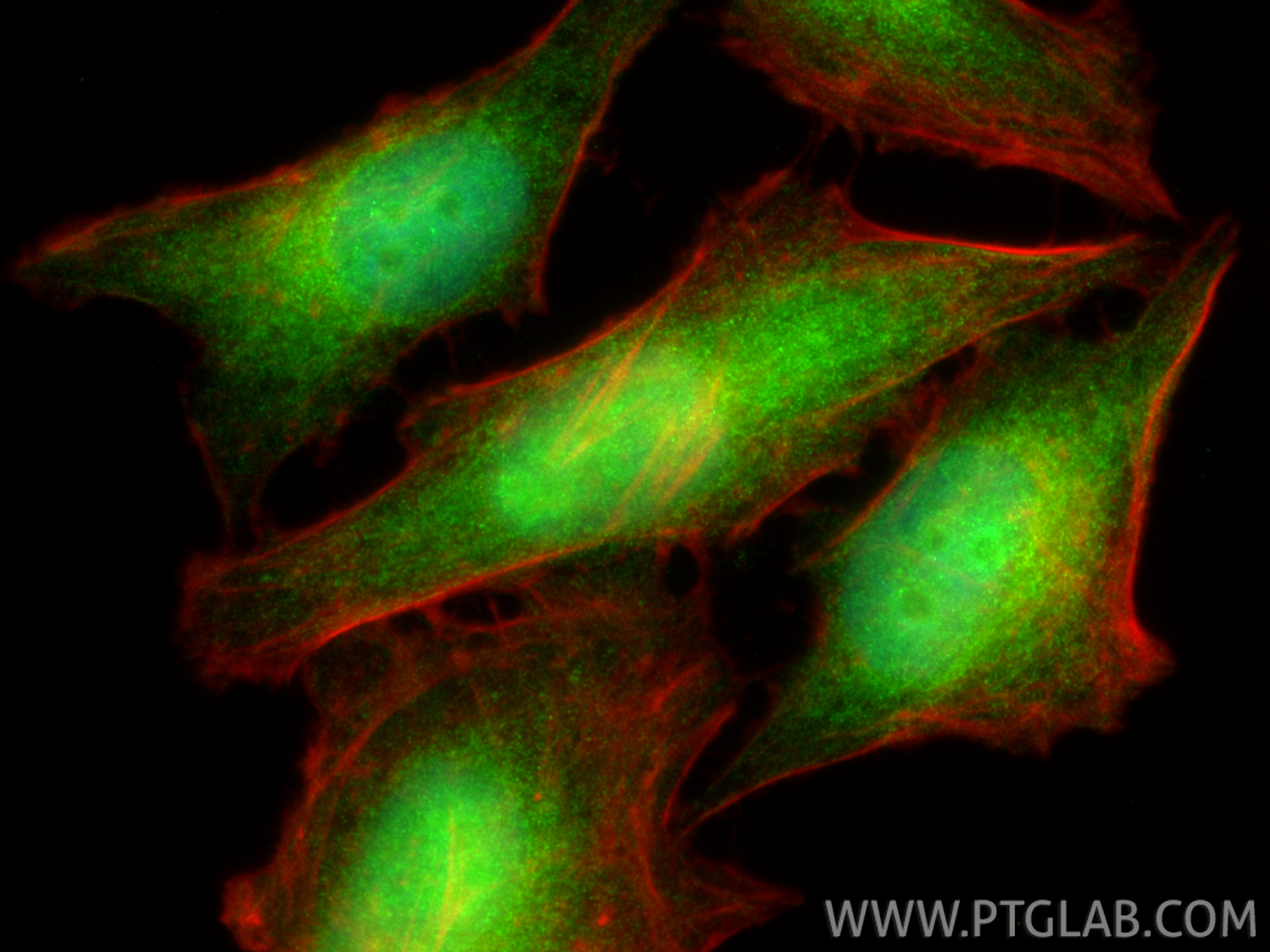 IF Staining of HeLa using 11619-1-AP