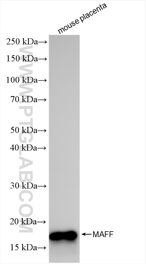 WB analysis using 85186-3-RR (same clone as 85186-3-PBS)