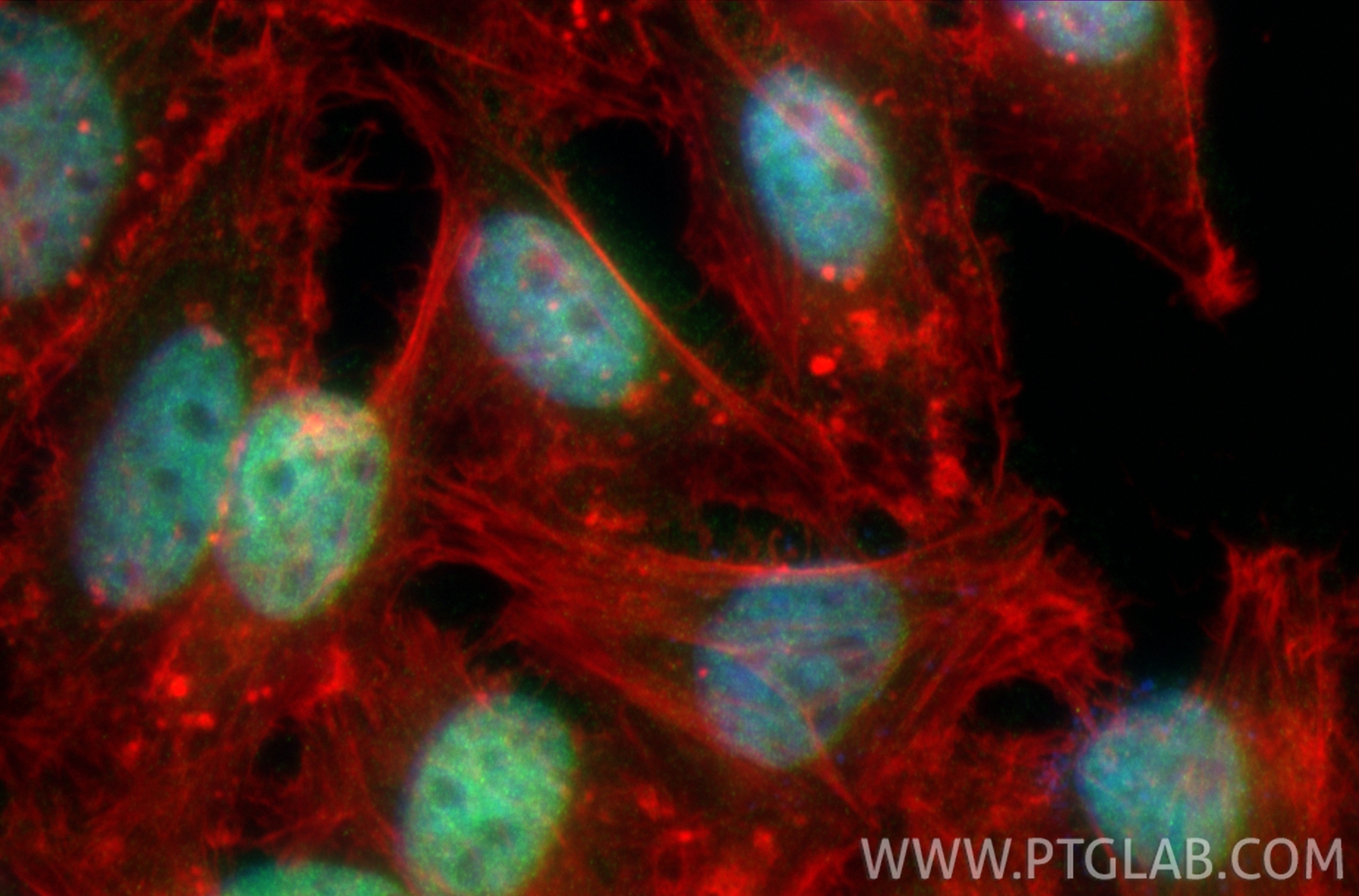 IF Staining of HeLa using 33199-1-AP