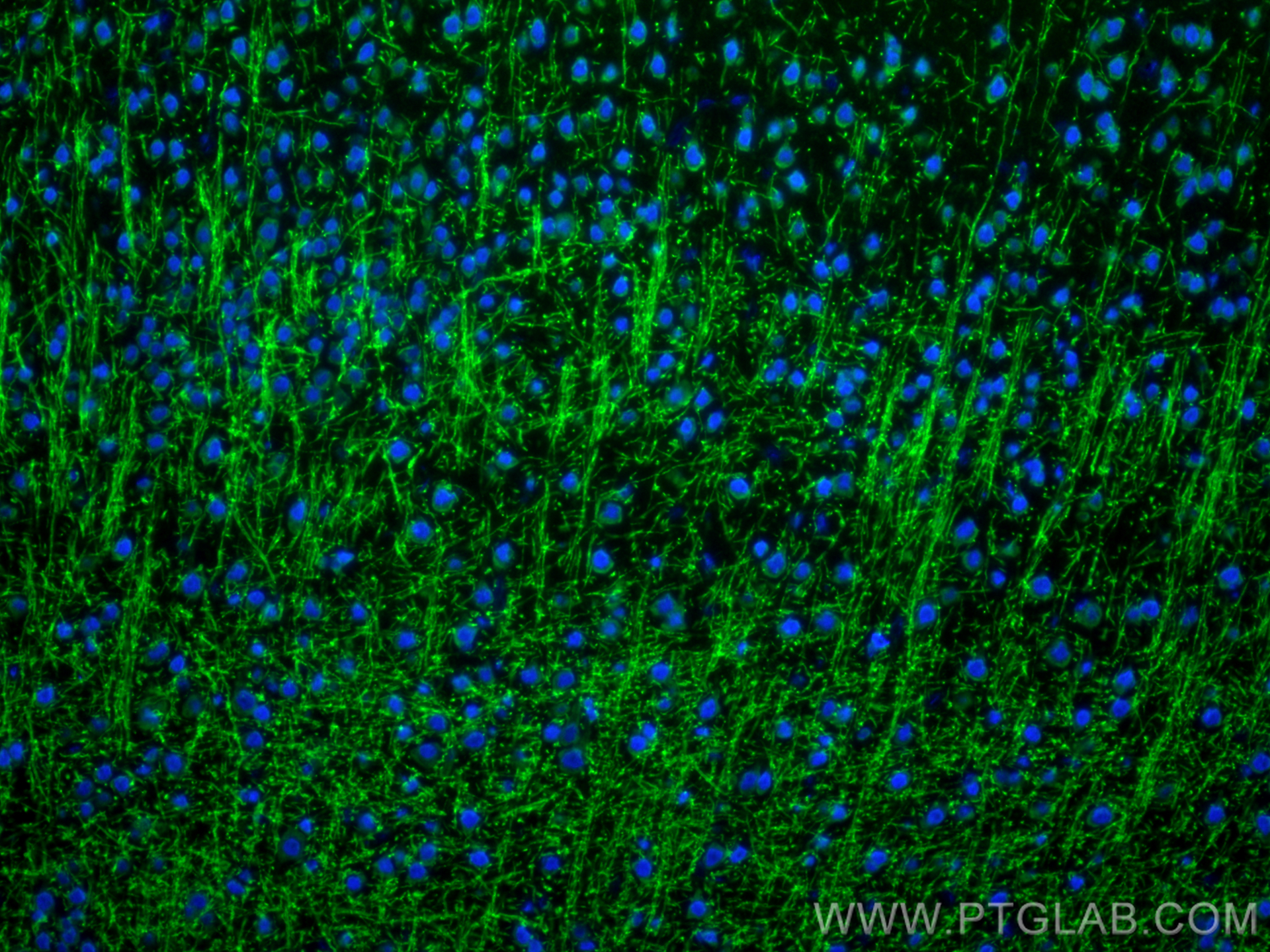 IF Staining of mouse brain using 14386-1-AP