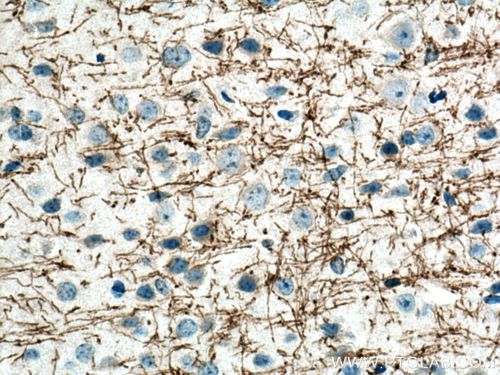 IHC staining of mouse brain using 14386-1-AP