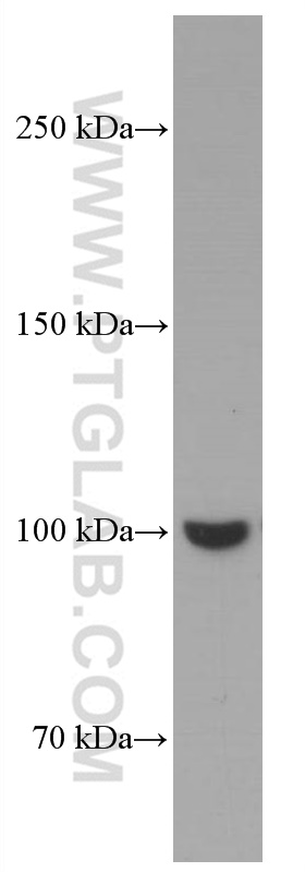 WB analysis of rat brain using 66709-1-Ig