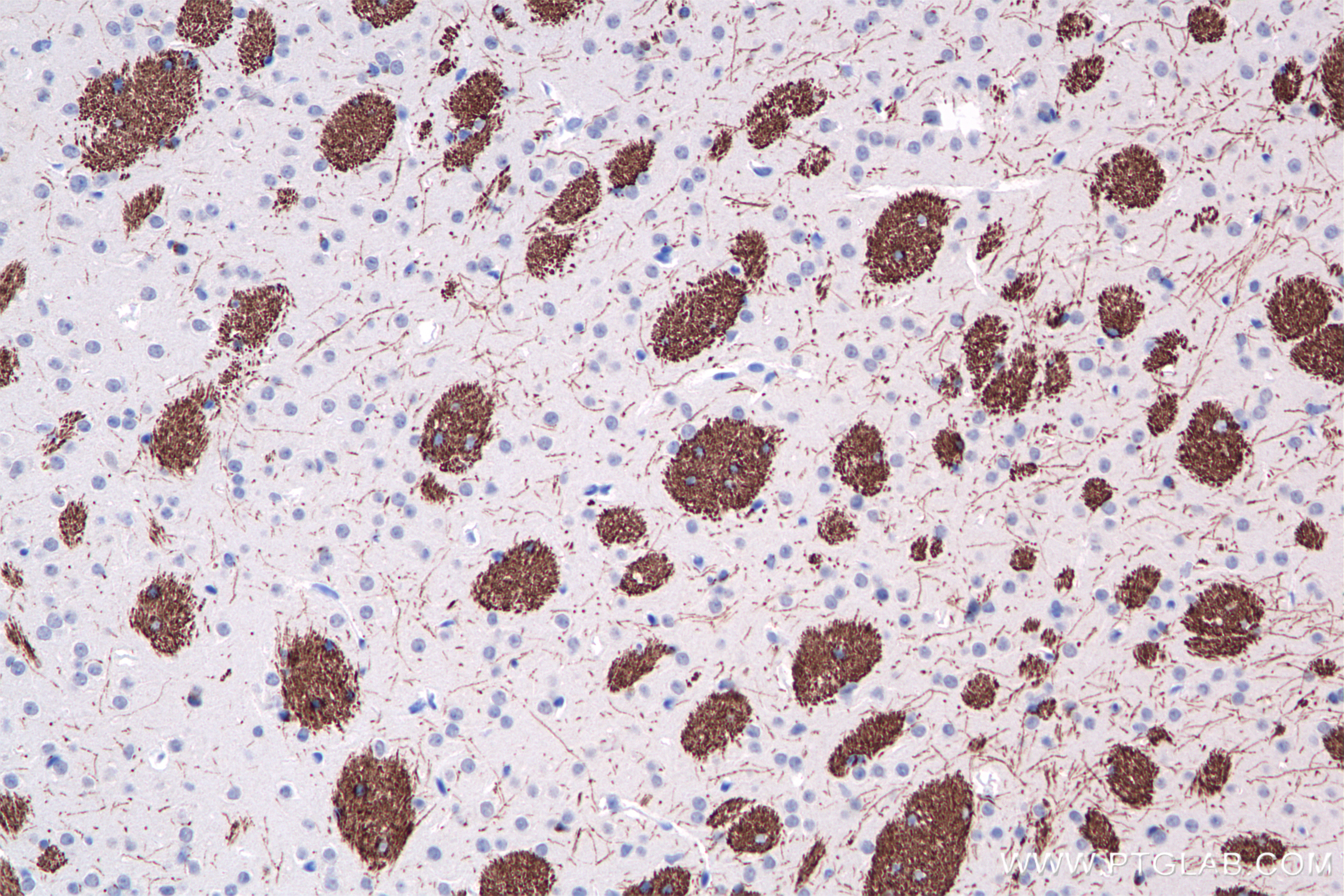 IHC staining of mouse brain using 86097-1-RR (same clone as 86097-1-PBS)