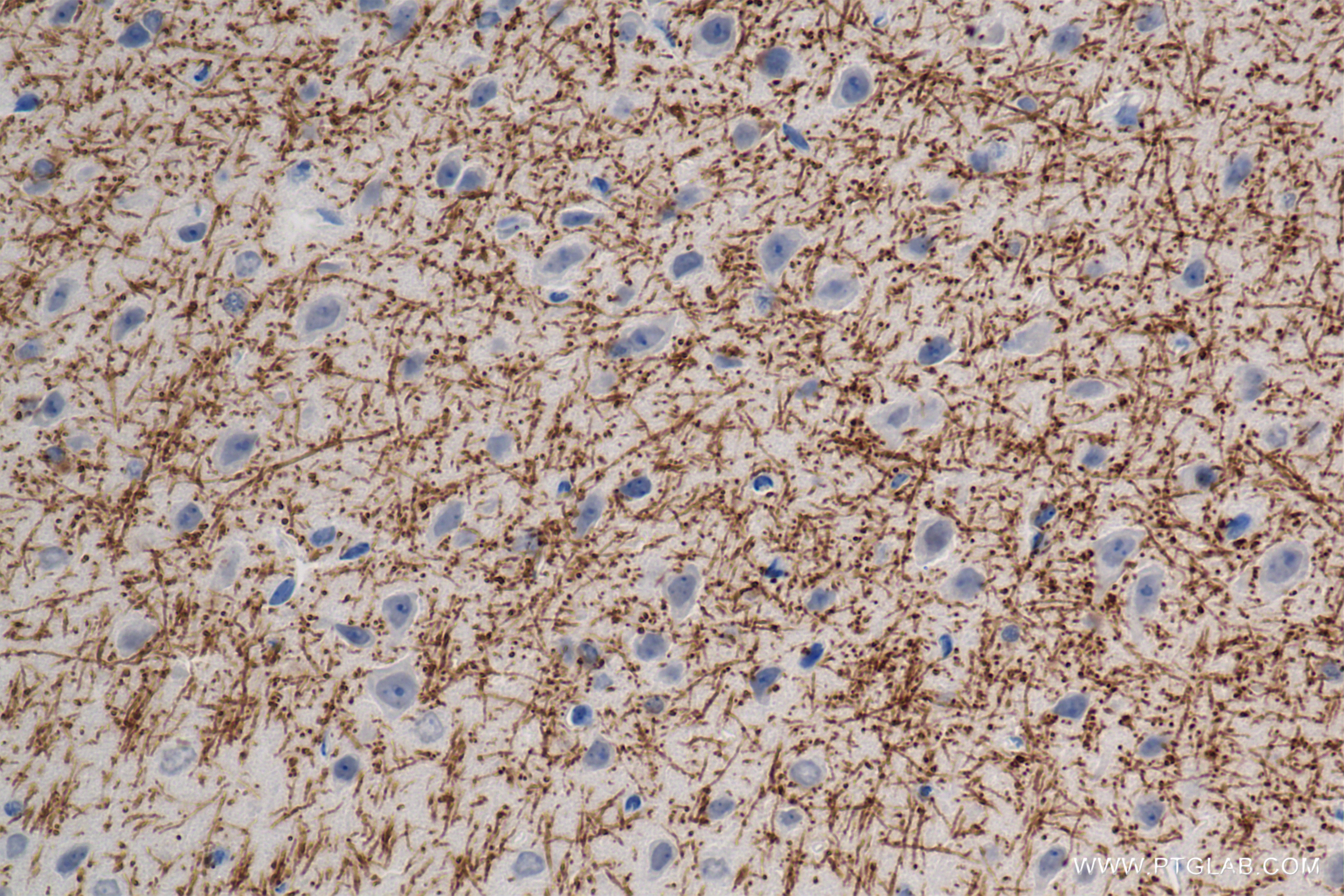 IHC staining of mouse brain using 86097-1-RR (same clone as 86097-1-PBS)