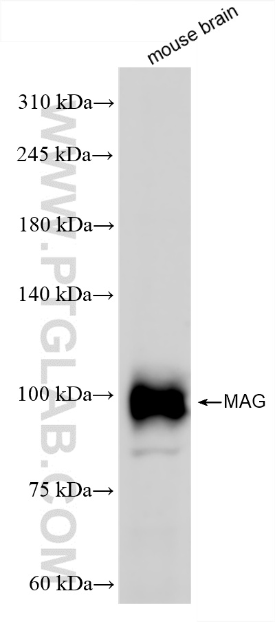 WB analysis of mouse brain using 86097-1-RR (same clone as 86097-1-PBS)