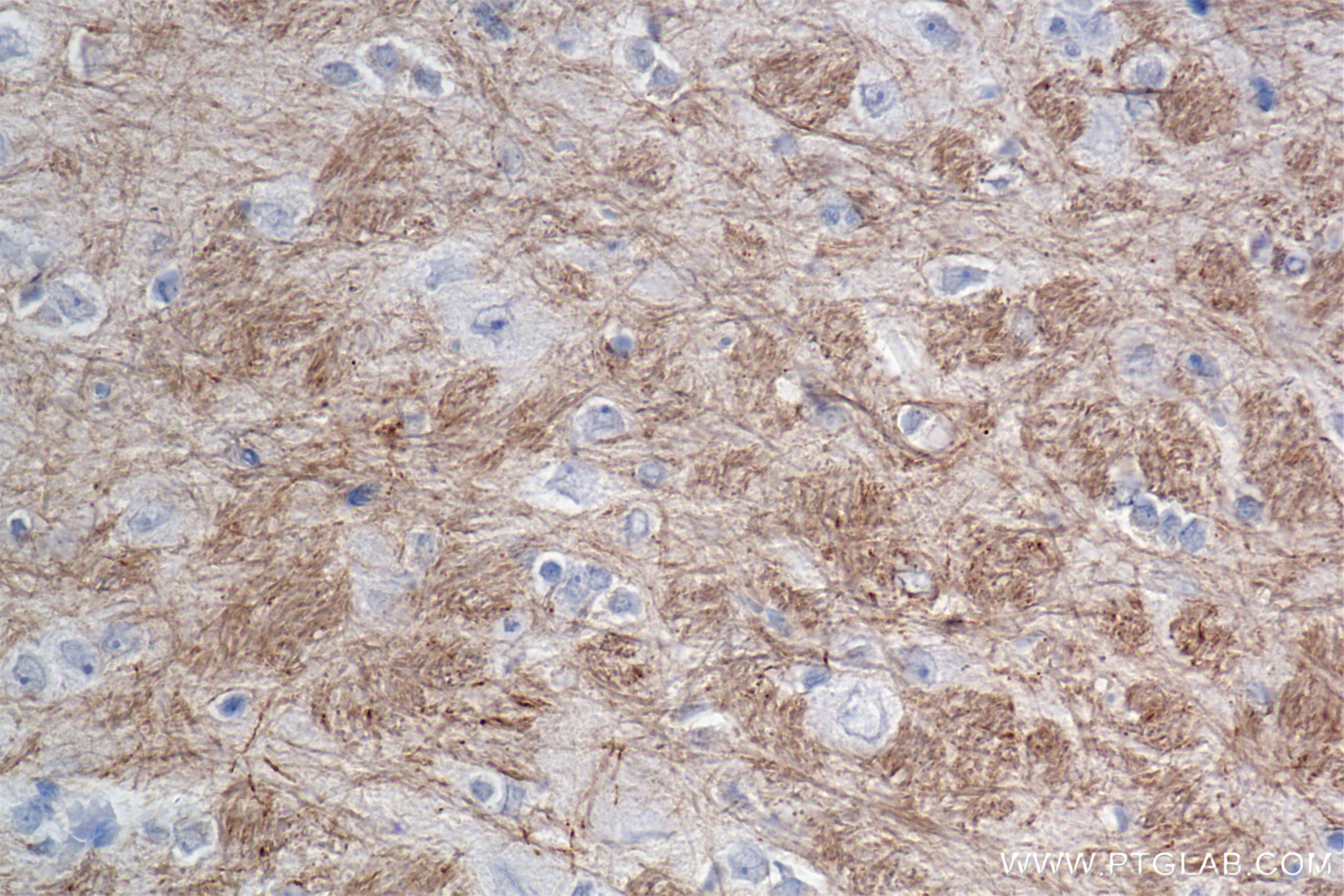 IHC staining of rat brain using 86073-2-RR