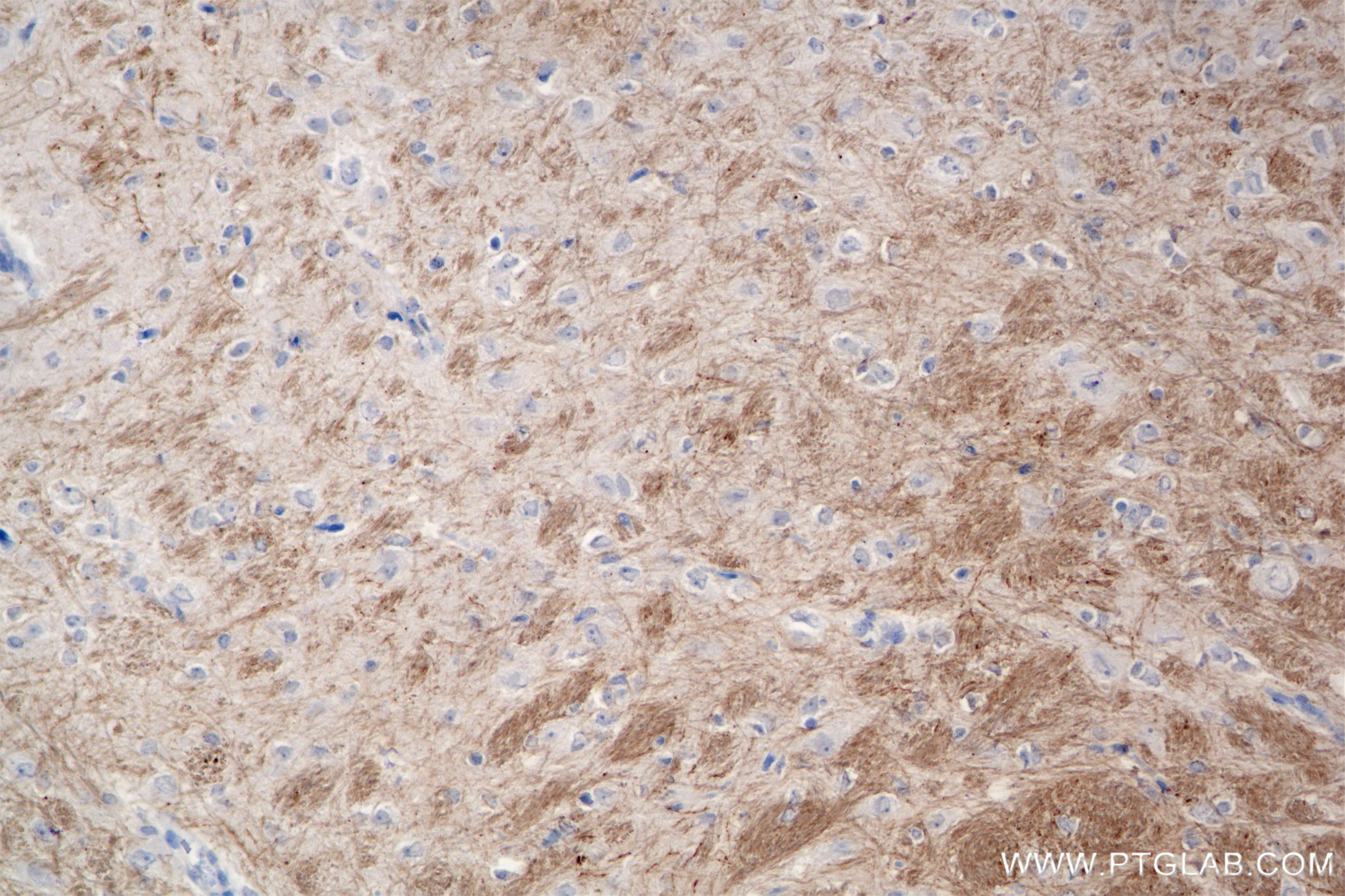 IHC staining of rat brain using 86073-2-RR