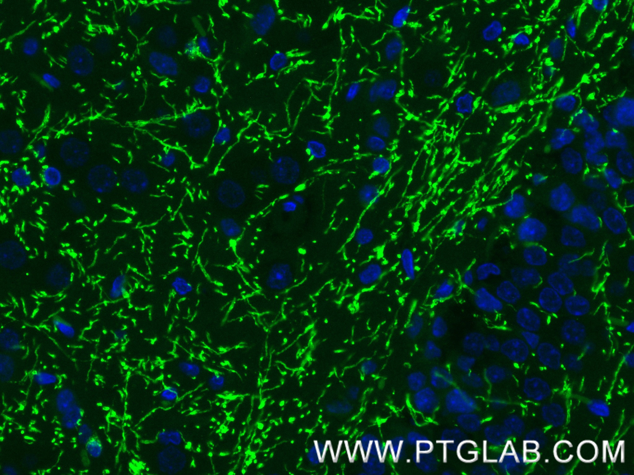 IF Staining of rat brain using 86073-3-RR