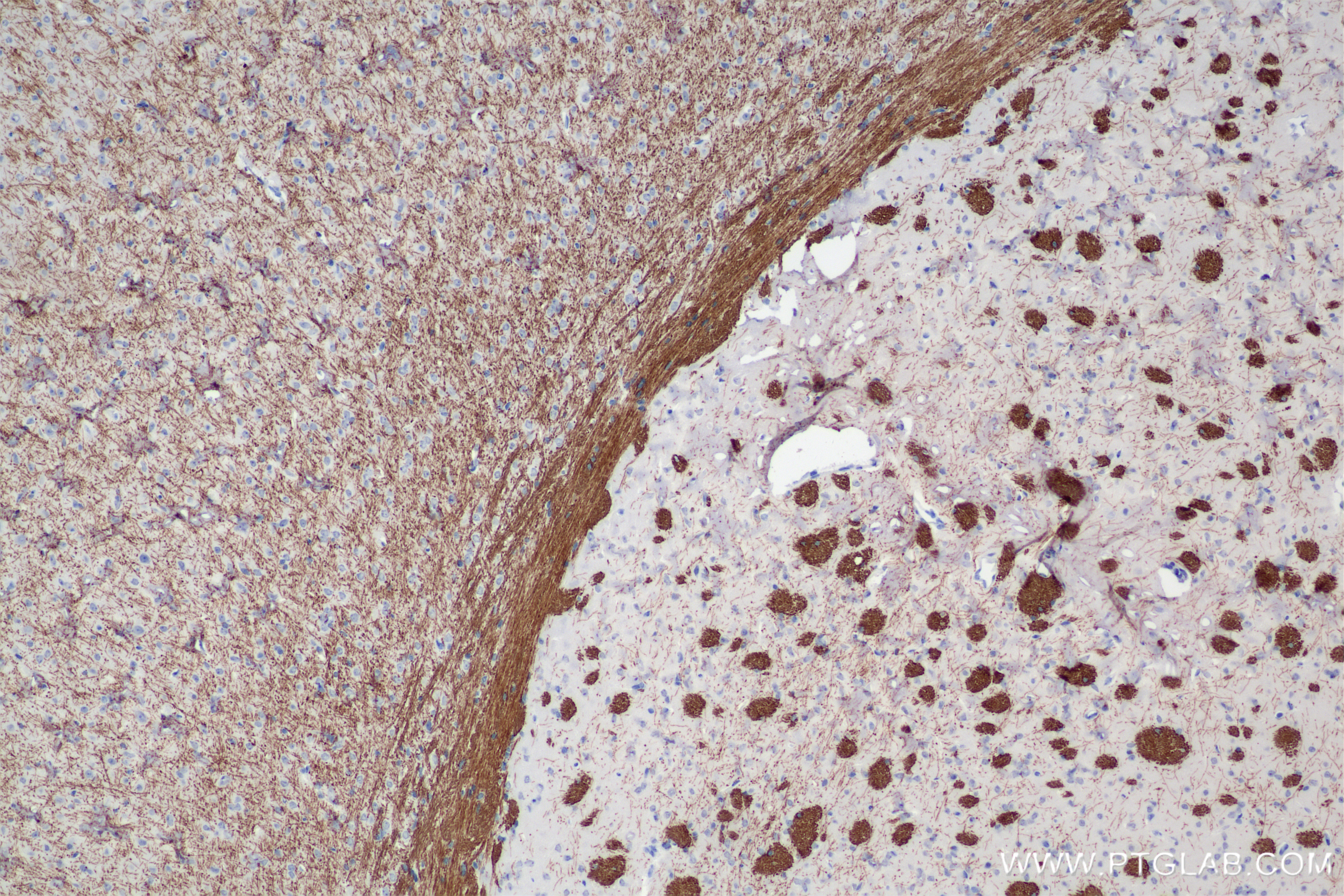 IHC staining of mouse brain using 86073-3-RR