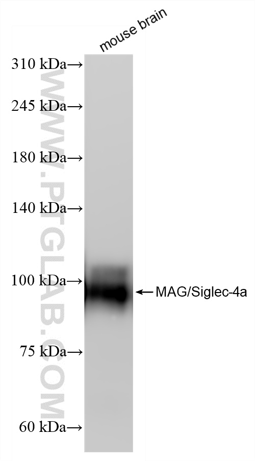 WB analysis of mouse brain using 86073-3-RR