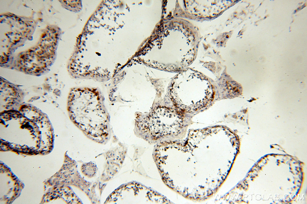 IHC staining of human testis using 12233-1-AP