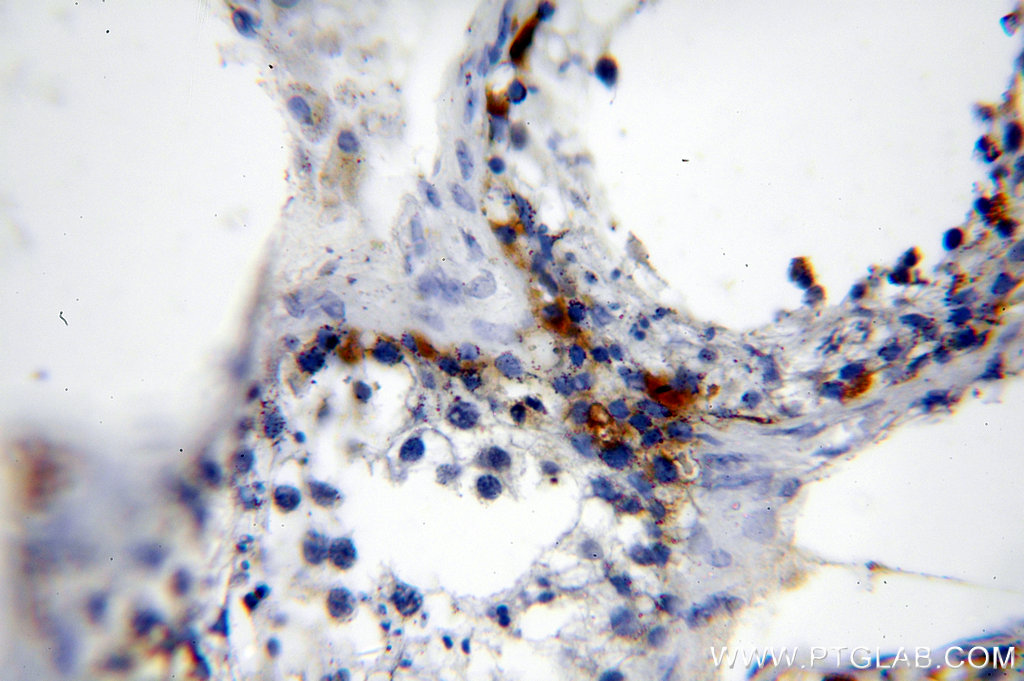 IHC staining of human testis using 12233-1-AP