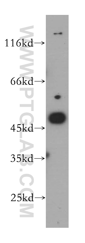 WB analysis of A375 using 15474-1-AP