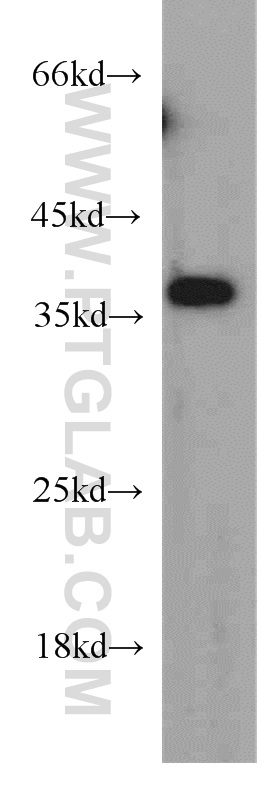 MAGEA4 Polyclonal antibody