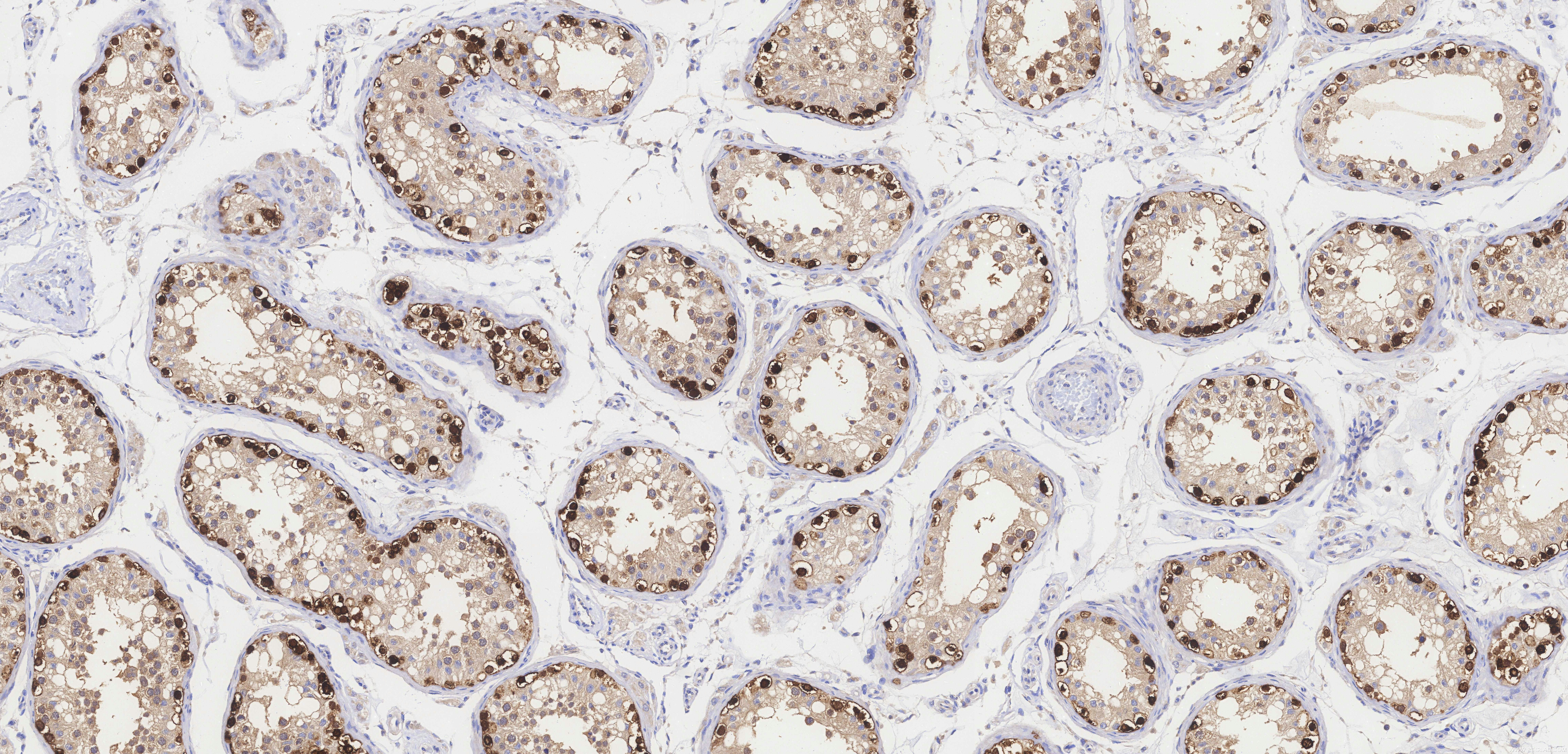 IHC staining of human testis using 84248-4-RR (same clone as 84248-4-PBS)