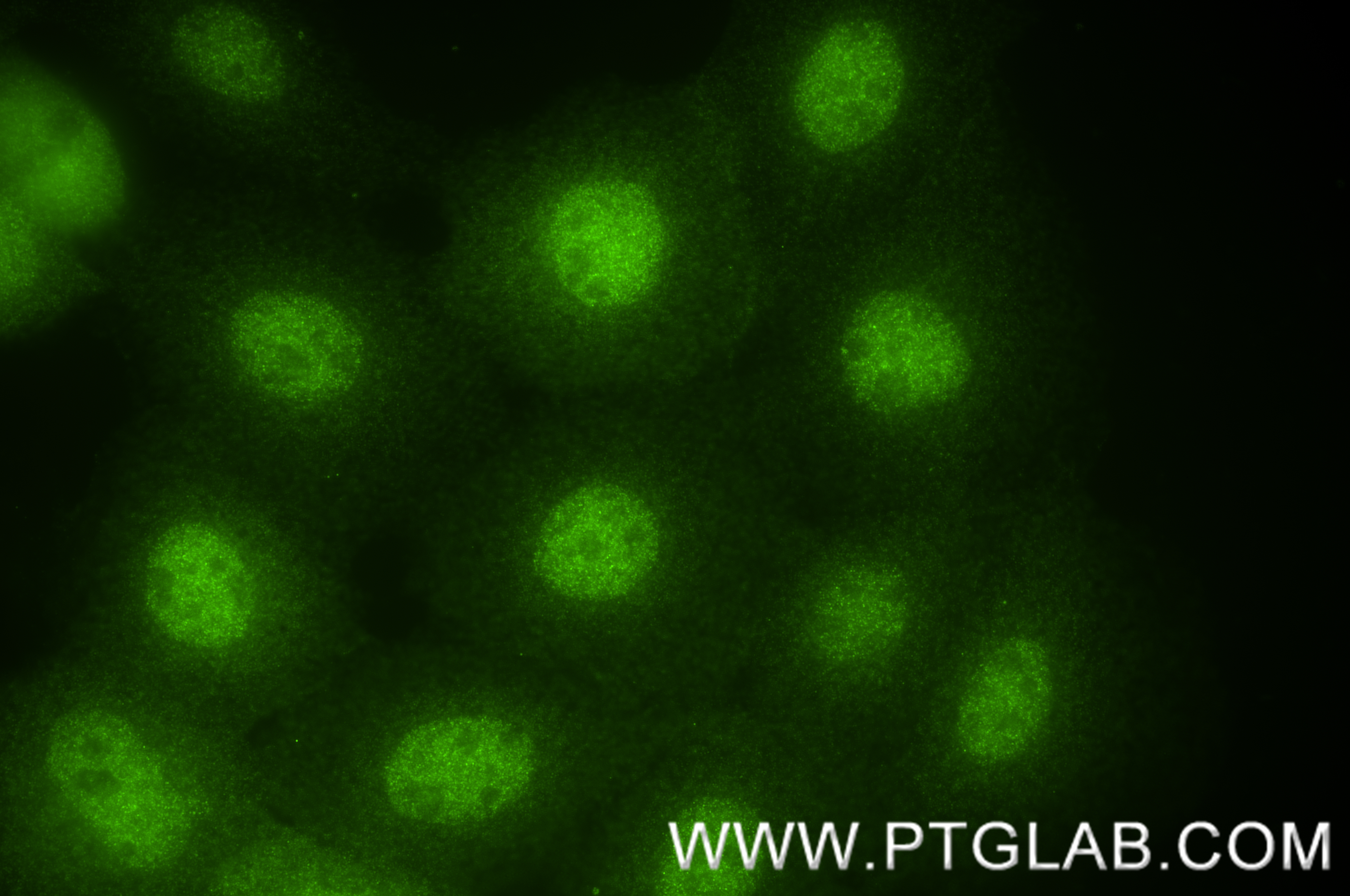 IF Staining of A431 using 84248-6-RR (same clone as 84248-6-PBS)