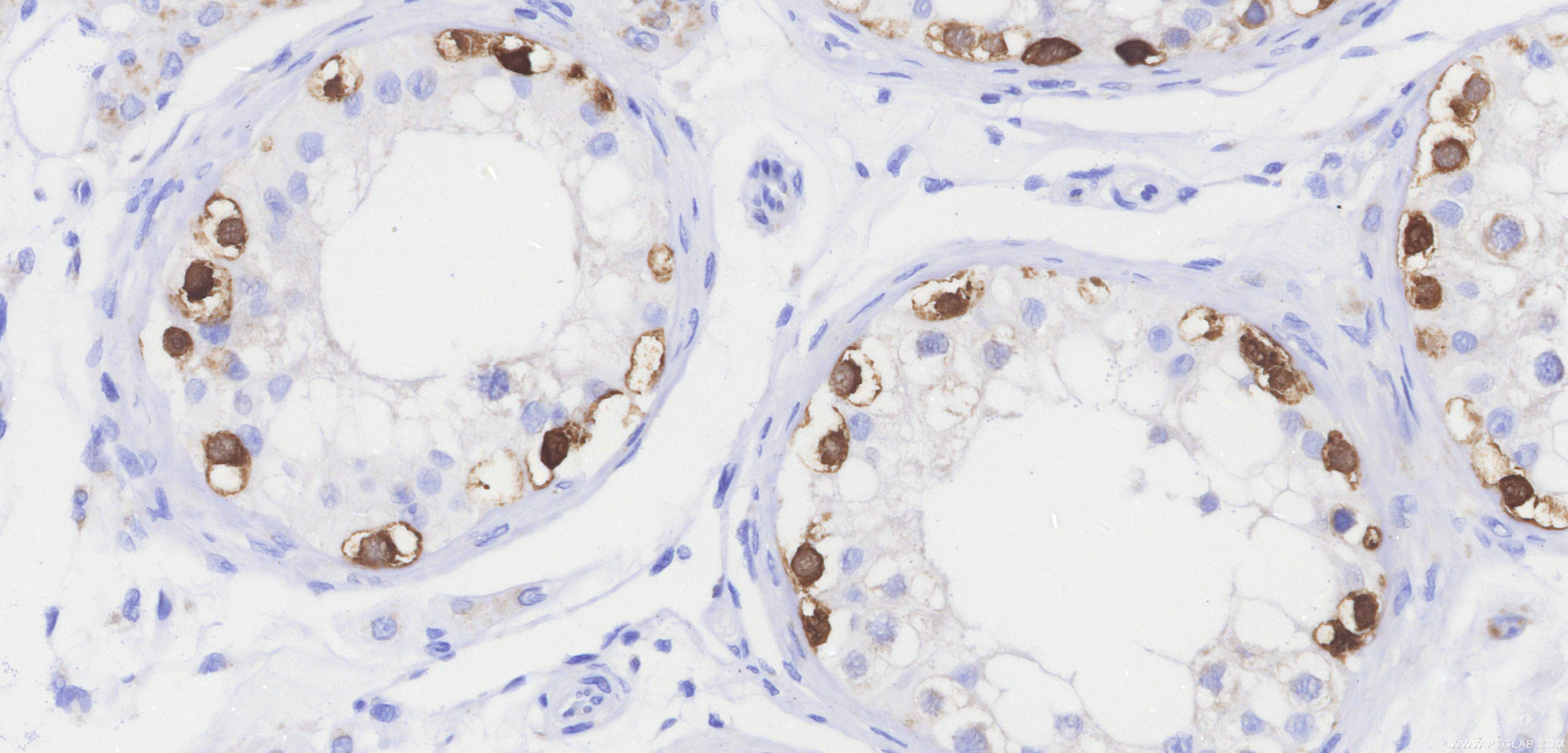 IHC staining of human testis using 84248-8-RR