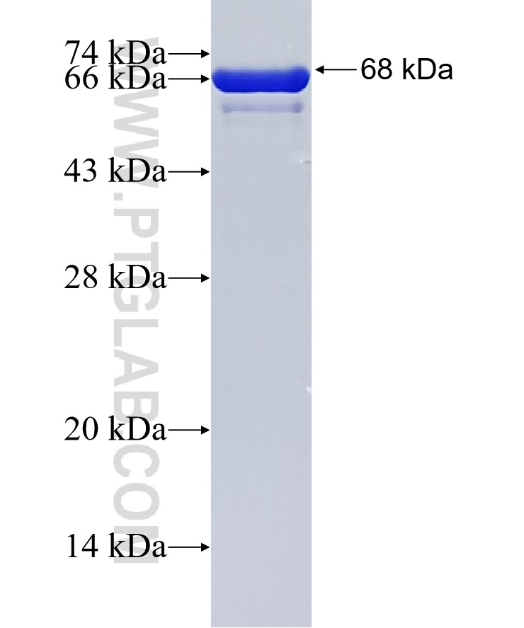 MAGEA4 fusion protein Ag3193 SDS-PAGE