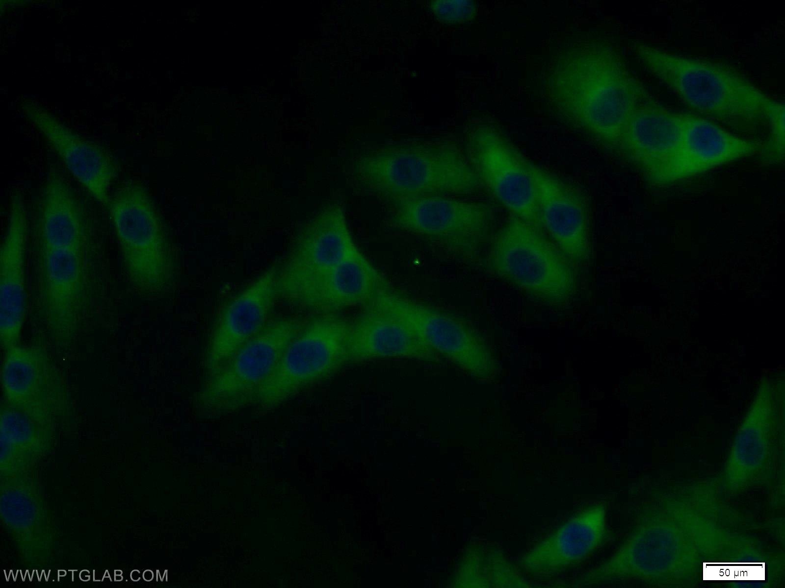 IF Staining of A375 using 14602-1-AP