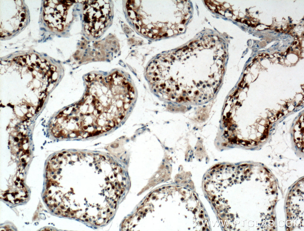 IHC staining of human testis using 15045-1-AP