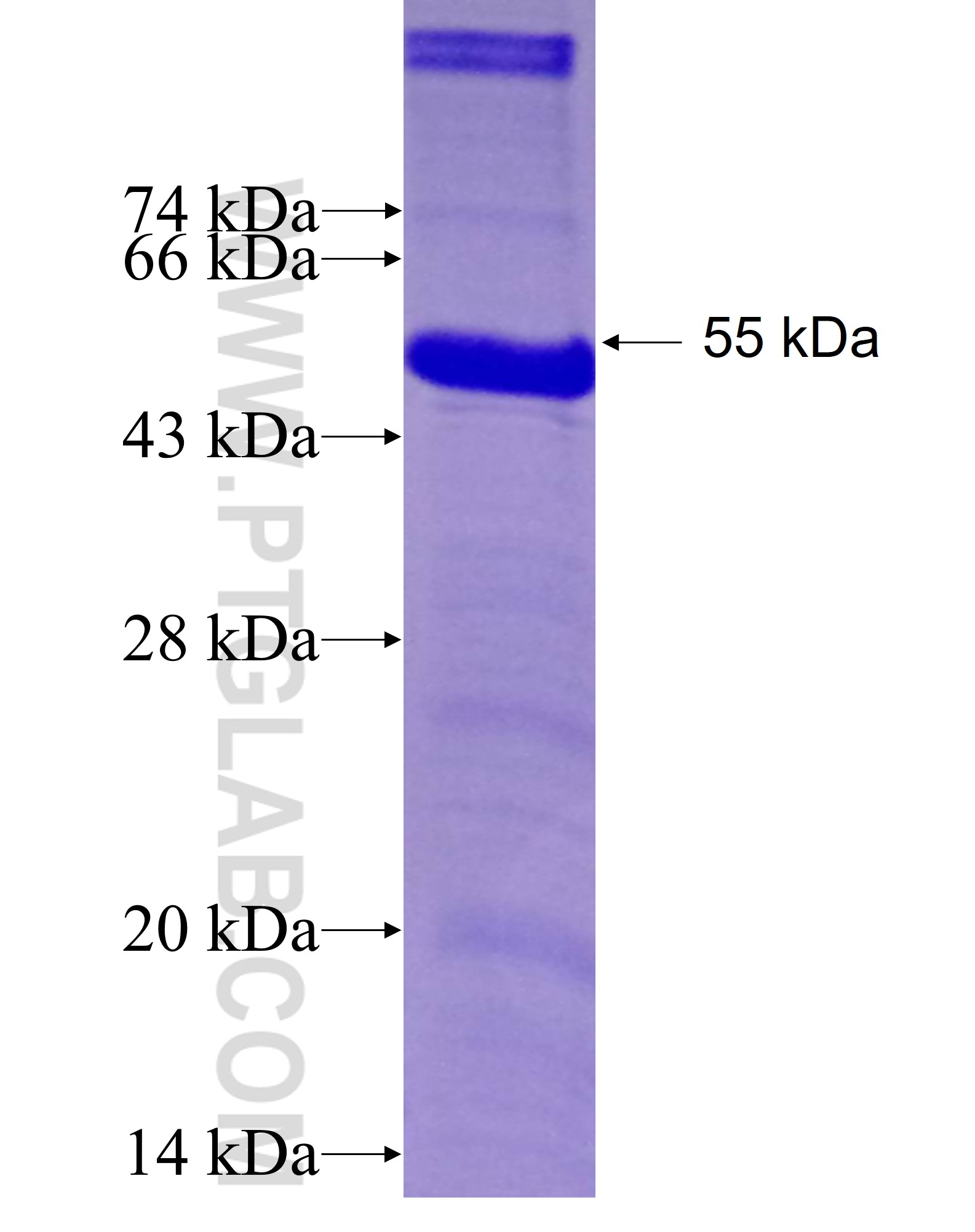 MAGEA8 fusion protein Ag7048 SDS-PAGE