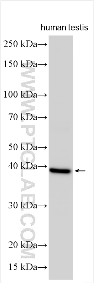 WB analysis using 14967-1-AP