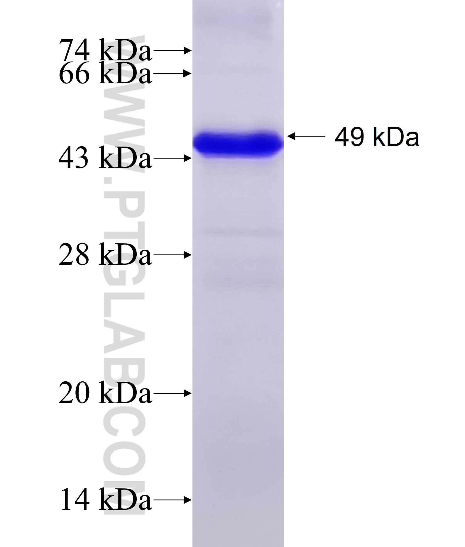 MAGEA9 fusion protein Ag7754 SDS-PAGE